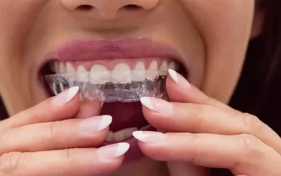 Invisalign Fullerton: Clear Aligner Therapy for Discreet Orthodontic Correction